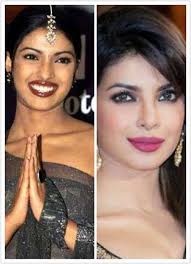 top 8 bollywood actresses who got skin