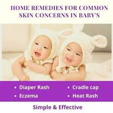 natural baby skin care home remes
