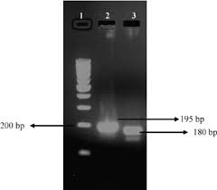 1 agarose gel electropsis in 1