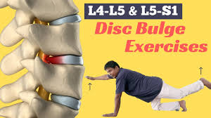 6 easy l4 l5 s1 bulging disc exercises
