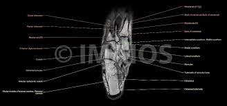 A magnetic resonance imaging (mri) was performed on a normal subject; Anatomy Of The Foot And Ankle Mri