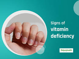 vitamin deficiency