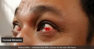 pain caused by corneal abrasion