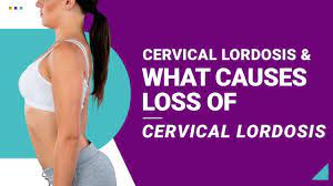cervical lordosis and what causes loss