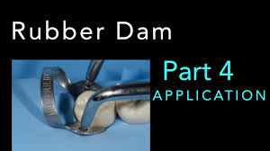 rubber dam isolation part 4 basic