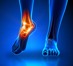 ankle foot heel pain treatment