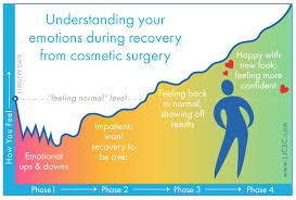 Your Emotions During Plastic Surgery Recovery Visual Ly