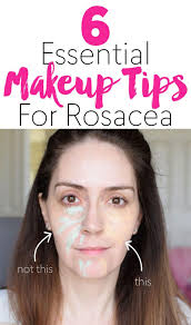 6 essential makeup tips for rosacea
