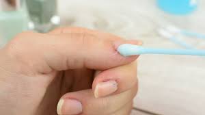 3 ways to whiten nails wikihow