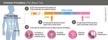 It may grow slowly and it's typically treatable. Prostate Specific Antigen Psa Test Results Levels Ranges