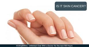 what causes black lines on skin and nails