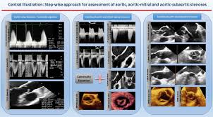 What Can 3d Echocardiography Add