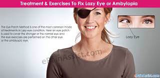I am going to go over with you 2 exercises that you guys need to do if you want. Treatment Exercises To Fix Lazy Eye Or Ambylopia