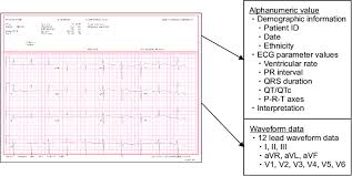 Example Of An Electrocardiogram Ecg Report Alphanumeric