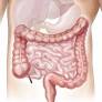 Diagnóstico y tratamiento Síndrome "intestino irritable" "colon irritable" de bufetmedic.es