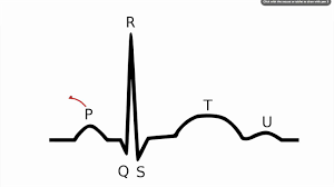048 How To Read An Electrocardiogram Ecg Ekg