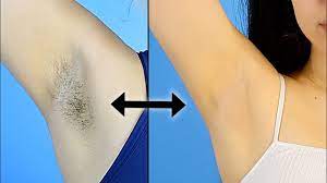 my armpit routine hair removal