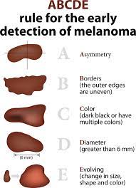 Skin cancer screening schedule if you have developed new moles, or a close relative has a history of melanoma, you should examine your body once a month. Learn The Abcdes Of Skin Cancer