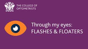 floaters and flashes