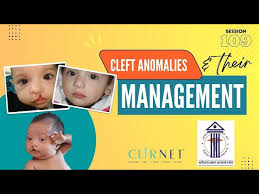 for cleft anomalies ica webinar