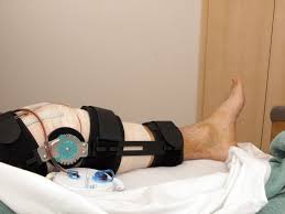 acl surgery recovery timeline osg