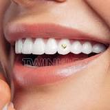 how-much-does-diamond-teeth-cost