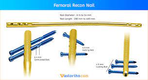 fem recon nail uses sizes