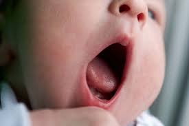 importance of cleaning baby tongue why