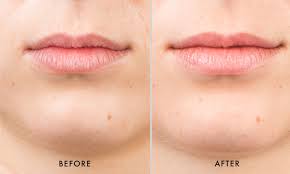 skinca ha5 smooth plump lip