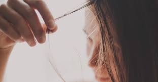 lupus hair loss pictures symptoms