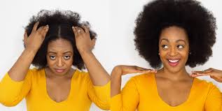 Of the many problems that plague women and hair care, a huge concern is how to alleviate or get rid of itchy scalp. Dry Itchy Scalp Treatment For Black Hair Archives Latoya Ebony