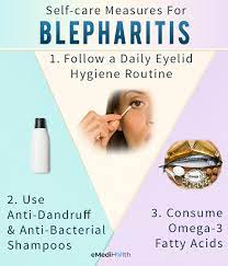blepharitis home remes self care