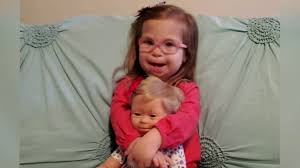 Down sendromu genetik bir anomalidir ve dünyada 6 milyonun üzerinde down sendromlu birey yaşamaktadır. Mom Gives Daughter With Down Syndrome Doll That Looks Like Her