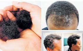 Tired of dealing with unruly locks and want to find the most amazing haircut to stick with? Why Your Hair Keeps Falling Out The Citizen