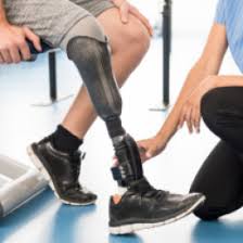 5 tips on caring for your prosthetic