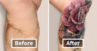 tattoo artist transformed scars into