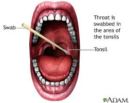 strep throat information mount sinai
