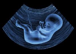Image result for ultrasound picture of a pregnant Muslim lady - Malaysia