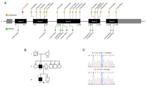 A Novel Missense Mutation In The Actg1 Gene In A Family With