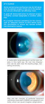 diagnose corneal lumps and ps