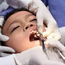 dental extraction in dubai abu dhabi