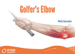 what is golfer s elbow optimum