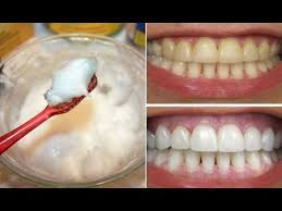 Doctors explain how to tell if you have a head cold or something more serious that requires medical attention, such as the flu, strep throat, meningitis, or mono. How To Whiten Your Yellow Teeth Naturally At Home à¤¦ à¤¤ à¤šà¤®à¤• à¤¨ Tooth Whitening Youtube