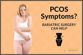 pcos symptoms treated with bariatric