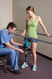 about access prosthetics access