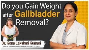 gain weight after gallbladder removal