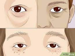 4 ways to improve under eye skin wikihow