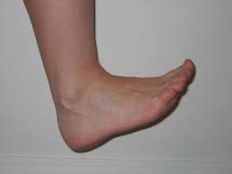 I tore my right ankle tendon and right leg ligament in 1990. Foot And Ankle Exercises For Injury Recovery And Prevention