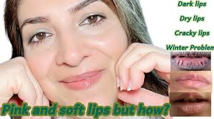 dry y dark lips how to get soft