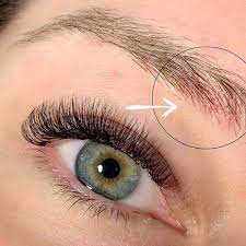 eyebrow dandruff what causes it how